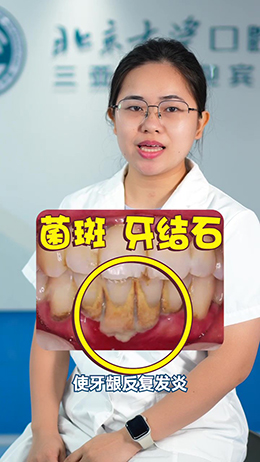 洗牙后牙縫變大的原因