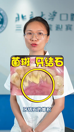 一刷牙就出血？別慌，看看醫(yī)生怎么說